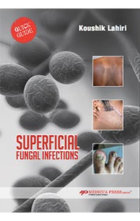 QUICK GUIDE SUPERFICIAL FUNGAL INFECTIONS
