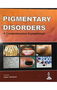 Pigmentary Disorders A Comprehensive Compendium